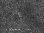 Ziarna węglanu wapnia (jasne) wytrącone na cząstkach pyłów atmosferycznych w tkance płucnej, widziane pod skaningowym mikroskopem elektronowym | fot. Mariola Jabłońska