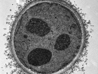 Drożdże Saccharomyces cerevisiae – zdjęcie wykonane pod transmisyjnym mikroskopem elektronowym | fot. Izabela Poprawa
