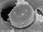 Okrzemki na powierzchni gąbki - nadecznika stawowego (Spongilla lacustris L). Fot. Jagna Karcz