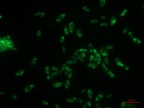Fotografia komórek szczepu Bacillus thuringiensis B1(2015b) wchodzącego w skład szczepionki mikrobiologicznej, wybarwionych barwnikiem fluorescencyjnym GFP | fot. Katarzyna Hupert-Kocurek