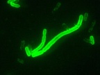 Pałeczka dżumy (Yersinia pestis). Fot domena publiczna
