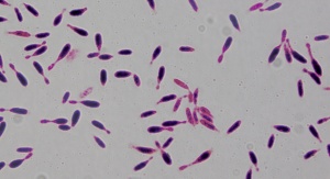 Gram-dodatna bakteria, Bacillus sp. B1(2015b) zdolna do metabolizowania ibuprofenu i naproksenu. Fot. Ariel Marchlewicz