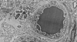 Przekrój badanego mózgu. Po prawej widoczna jest komórka krwionośna, po lewej znalezione ślady bakterii. Foto. Rosalinda Roberts i in. 