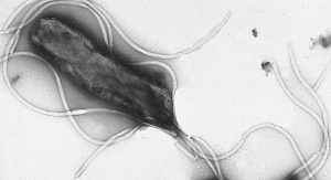 Helicobacter pylori pod mikroskopem. By Yutaka Tsutsumi, M.D.ProfessorDepartment of PathologyFujita Health University School of Medicine - Yutaka Tsutsumi, M.D.ProfessorDepartment of PathologyFujita Health University School of Medicinehttp://info.fujita-hu.ac.jp/~tsutsumi/photo/photo002-6.htmhttp://info.fujita-hu.ac.jp/~tsutsumi/image/002/2-6.jpg, Copyrighted free use, https://commons.wikimedia.org/w/index.php?curid=535442