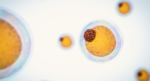 komórka tłuszczowa - żółte komórki z błękitną, przeźroczystą błoną