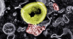 Obraz wewnątrz komórki wykonany przy użyciu mikroskopu elektronowego - oznaczone na czerwono nanocząstki w interakcji z oznaczoną na żółto bakterią. Źródło: Empa