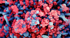 Kolorowa skaningowa mikrografia elektronowa komórki (kolor niebieski) silnie zakażonej wirusem SARS-CoV-2 (kolor czerwony), wyizolowanej z próbki pacjenta | Image credit: NIAID