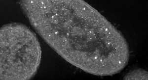 Nanocząstki srebra wewnątrz komórki bakteryjnej. Źródło: http://soundofscience.info/wp-content/uploads/si-zombies.jpg