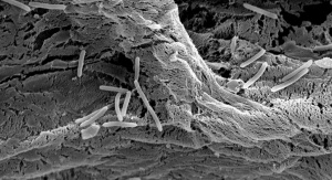 Fotografia komórek szczepu Pseudomonas moorei KB4 unieruchomionych na powierzchni gąbki roślinnej | fot. Urszula Guzik