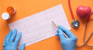 wyniki badań EKG