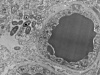 Przekrój badanego mózgu. Po prawej widoczna jest komórka krwionośna, po lewej znalezione ślady bakterii. Foto. Rosalinda Roberts i in. 