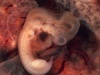 Zdjęcie zarodka w siódmym tygodniu ciąży. Fot. By Ed Uthman, MD (Flickr, Wikipedia) (http://www.flickr.com/photos/euthman/304334264) [Public domain], via Wikimedia Commons