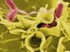 Bakterie Escherichia coli (Foto: pixabay.com)