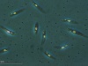  Wiciowce z gatunku Leishmania tropica wywołujące leiszmaniozę skórną. Fot. By Doc. RNDr. Josef Reischig, CSc. (Author's archive) [CC BY-SA 3.0 (http://creativecommons.org/licenses/by-sa/3.0)], via Wikimedia Commons