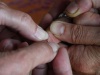 Wyjmowanie drzazgi z palca