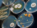 Kolorowe bakterie na szkiełku | fot. luchschen/Fotolia